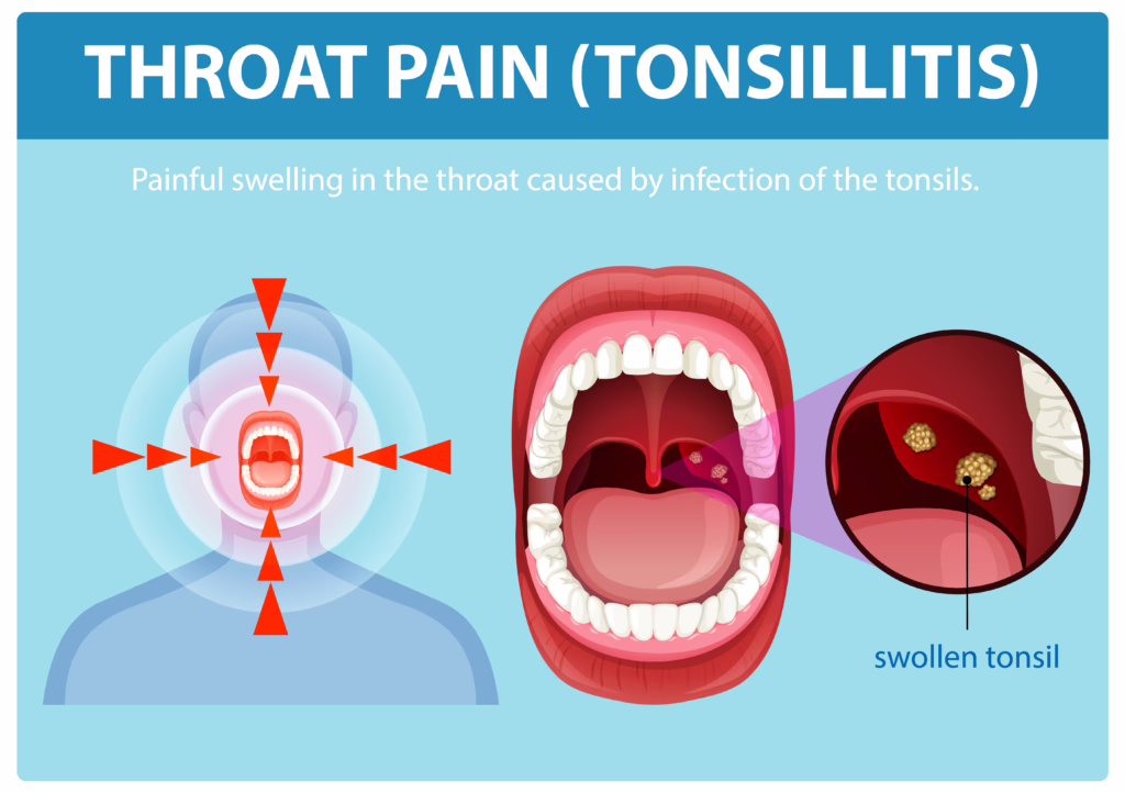 Best ENT doctor for tonsils in Bangalore